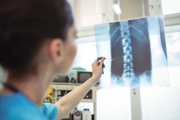doctor examining xray